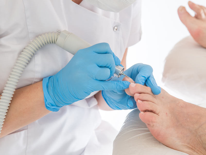 Barker & Bennell | Podiatrists & Chiropodists | Welling